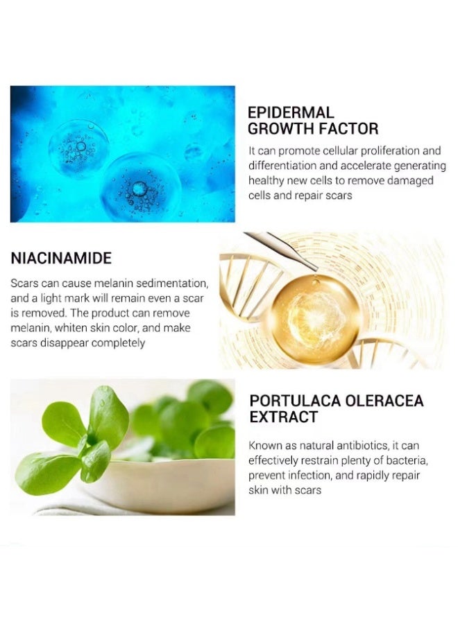 SOL LORA Multi-Effect Scar Removal Cream, Acne Treatment, Scar Fading, and Blemish Smoothing 30g - Image 4